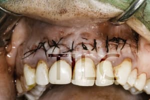 20090629  mg 0038 rl6dbd - Eugenol