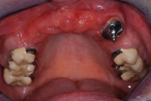 2010 12 14 013 sxpgfa - Eugenol