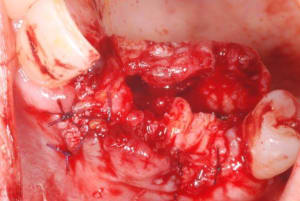2011 09 15 011 nduqf3 - Eugenol