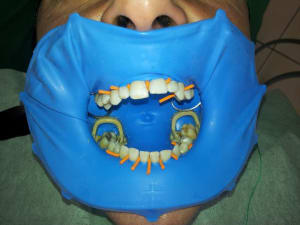 20120213 144051 t1grwi - Eugenol