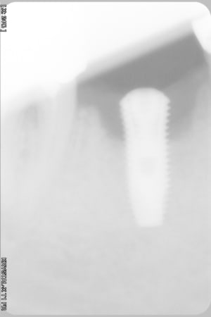 2012c dr8y60 - Eugenol
