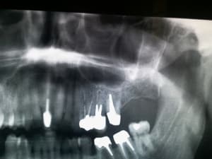 20140115 090401 uuhftf - Eugenol