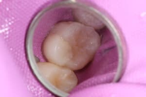 2015 07 25 14.26 - Eugenol