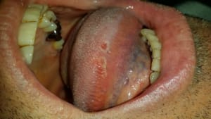 20151210 173606 gxtrz1 - Eugenol