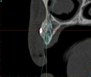 23bis rnpn2s - Eugenol