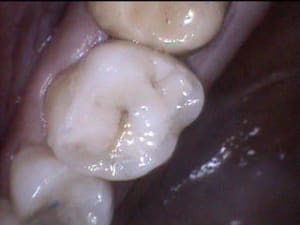 2  - Eugenol