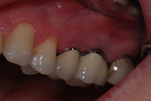 2 avt ext swkzaw - Eugenol