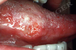 2 br1n2d - Eugenol