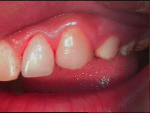 2bis gwdkbq - Eugenol