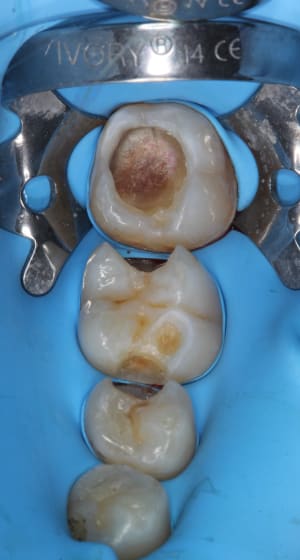 3 - Eugenol