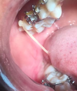 34b28bb8 aef4 4298 80c1 01628a02309c jqh5o8 - Eugenol