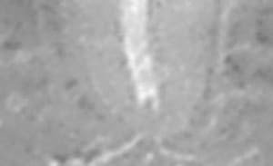 35 apex 07 03 13 dqsjlm - Eugenol