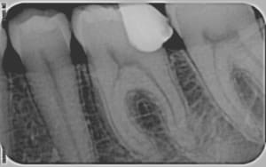 36 s7j83d - Eugenol