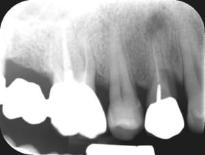 3823 20130802 09 08 19 mrjbvz - Eugenol
