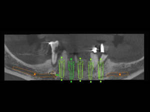 3dslice1 2011 06 19 21 03 22 iccb9s - Eugenol