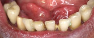 3  3  xv3uir - Eugenol