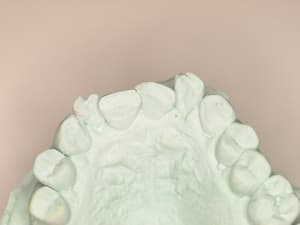 3 lkanv2 - Eugenol
