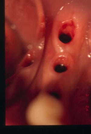 3 mois bsvudw - Eugenol