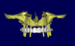 3d1 wo7dci - Eugenol