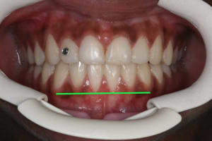 41 copie jymuln - Eugenol