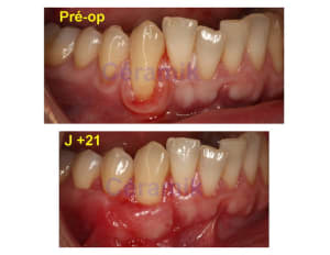 43 44 aeqamo - Eugenol