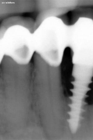 43x1 i2o9ni - Eugenol