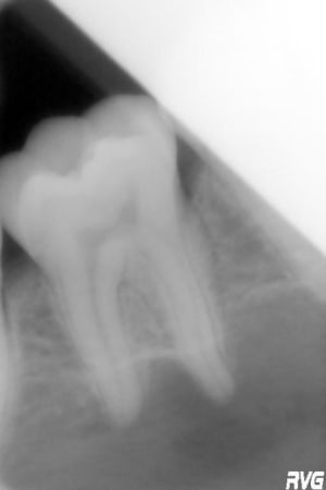 46 e4icn7 - Eugenol