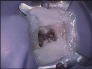 47 pose digue hzl3d6 - Eugenol