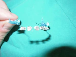 4 banded bracket wesq5j - Eugenol