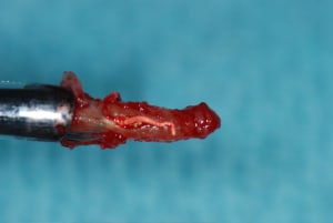 4racine m4o4fb - Eugenol