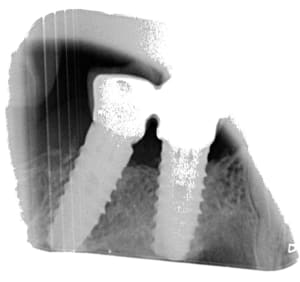 5350 x 20150330 171333 xfl32m1cmt2v 4 aok9ub - Eugenol