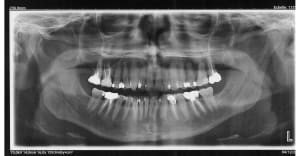 59i7iqjymj1dyh6xp4aasm483kh0 - Eugenol