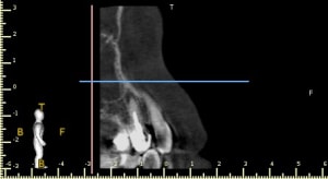 5 paa0 sagittal view lhrm1b - Eugenol