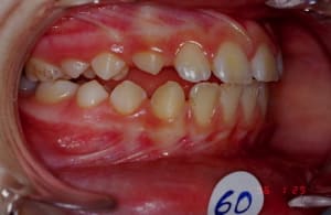 5 rgkioo - Eugenol