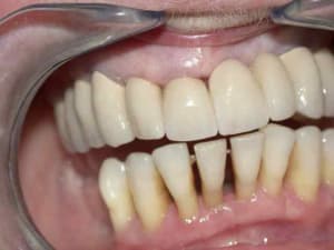 6 ans avant wt6kfx - Eugenol