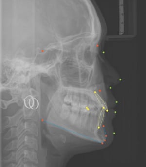 6y4jzkofysgbxtahstsz451cm2jj - Eugenol
