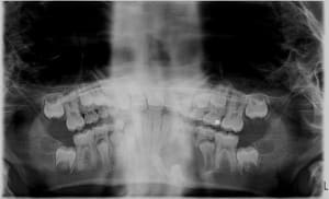 73 74 75 a693at - Eugenol