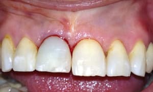 7 wrgsgl - Eugenol