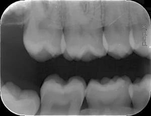 7xe29lyj2qy4nnshmrkse2qj0g73 - Eugenol