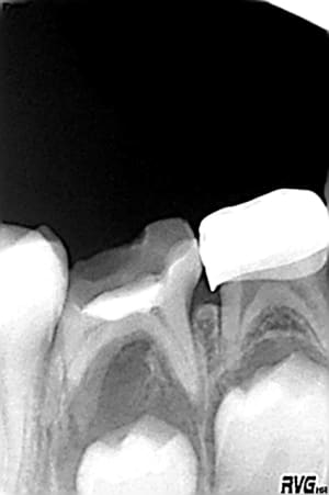 85 en 2007 umqpaf - Eugenol