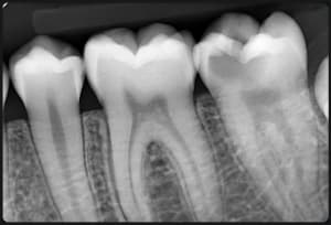 9ga4rv7suwrtqr0jexxcw2u2n6s4 - Eugenol