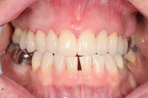 A6 rvq8wn - Eugenol
