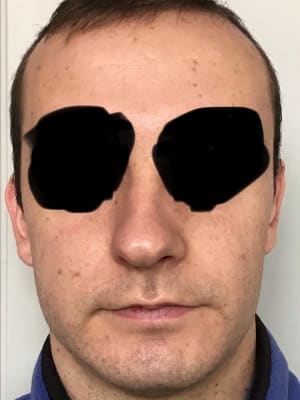 A82f03fd 2d91 4ef1 97ca f3eb47c7b10d m438gf - Eugenol