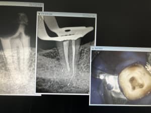 Aab4c4e5 aaa6 4d8a 98fc dd3da741e8a4 rlse01 - Eugenol