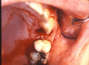 Alexis serge 2 v0us5g - Eugenol
