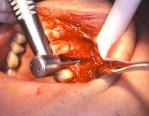 Alexis serge 5 cbtv0h - Eugenol