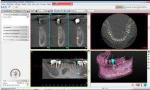 Alpha omega tango vj4m5o - Eugenol