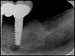 Am convertimage n4od5s - Eugenol