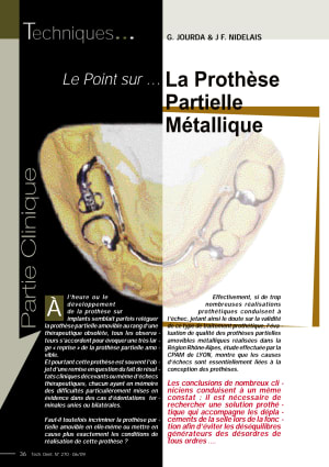 Article technologie dentaire wwwlwa - Eugenol