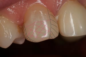 Ag n sie retouche c4ugkl - Eugenol